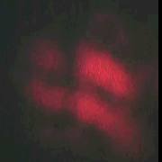 Interferens-fringes
